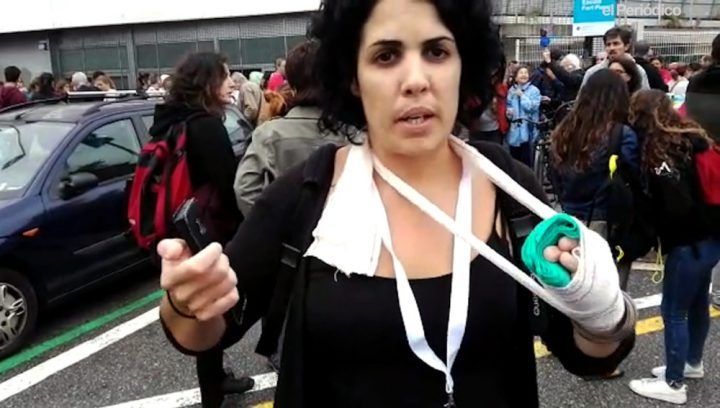 La joven que denunció que la Policía le había roto los dedos admite ahora que sólo tiene una inflamación