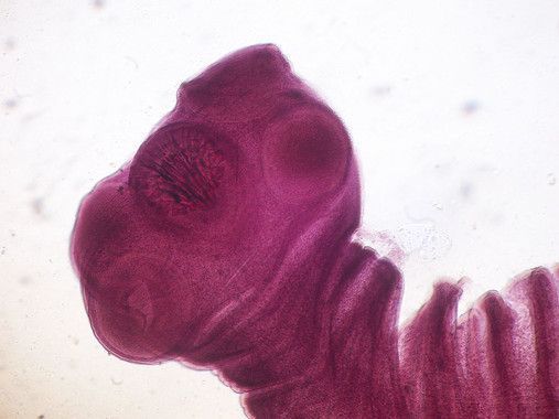 Epidemiología: Primeros datos sobre las infecciones por tenia en España