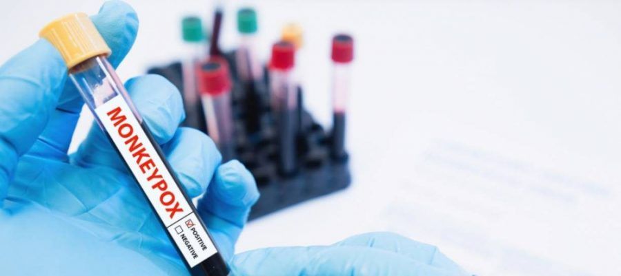 El contacto piel con piel es la causa más probable de transmisión de viruela del mono