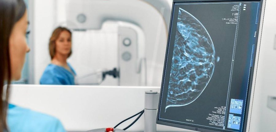 Las células son capaces de transformar cambios mecánicos en respuestas biológicas. Este proceso se conoce cómo mecanotransducción y tiene un papel fundamental en la evolución de los tumores sólidos, como el cáncer de mama. / IBEC