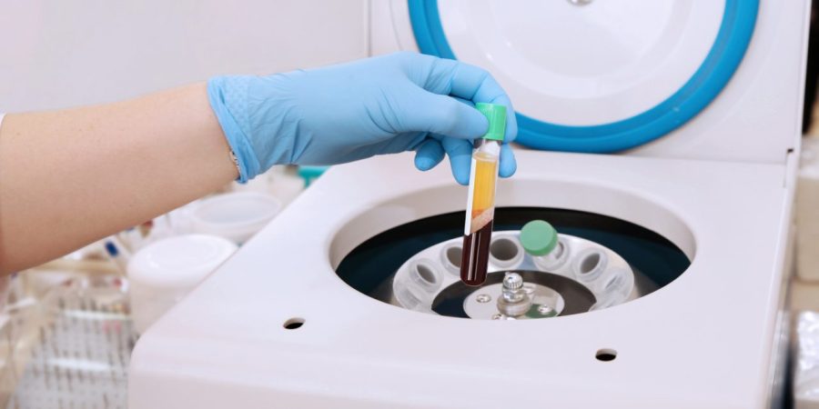 Médicamente hablando: El potencial del plasma rico en plaquetas en traumatología y cirugía ortopédica