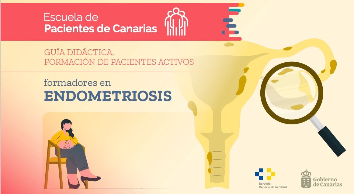 Canarias, pionera en la elaboración de una guía didáctica para pacientes con endometriosis dentro de la Escuela de Pacientes